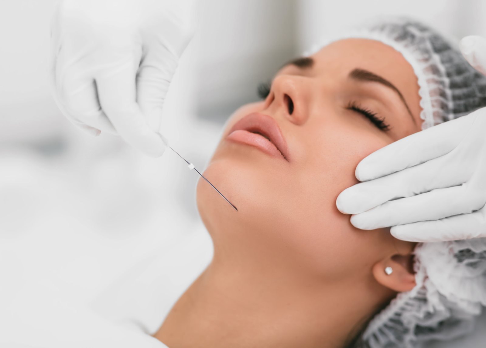 Laser Genesis treatment at Skin&Co, Mississauga