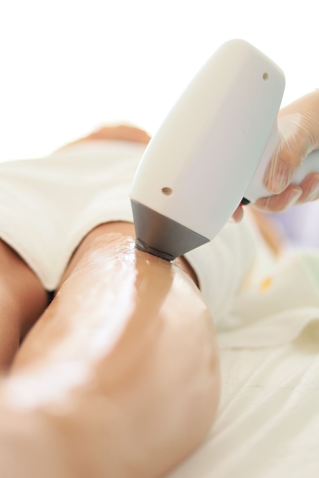 Laser and Energy at Skin&Co, Mississauga