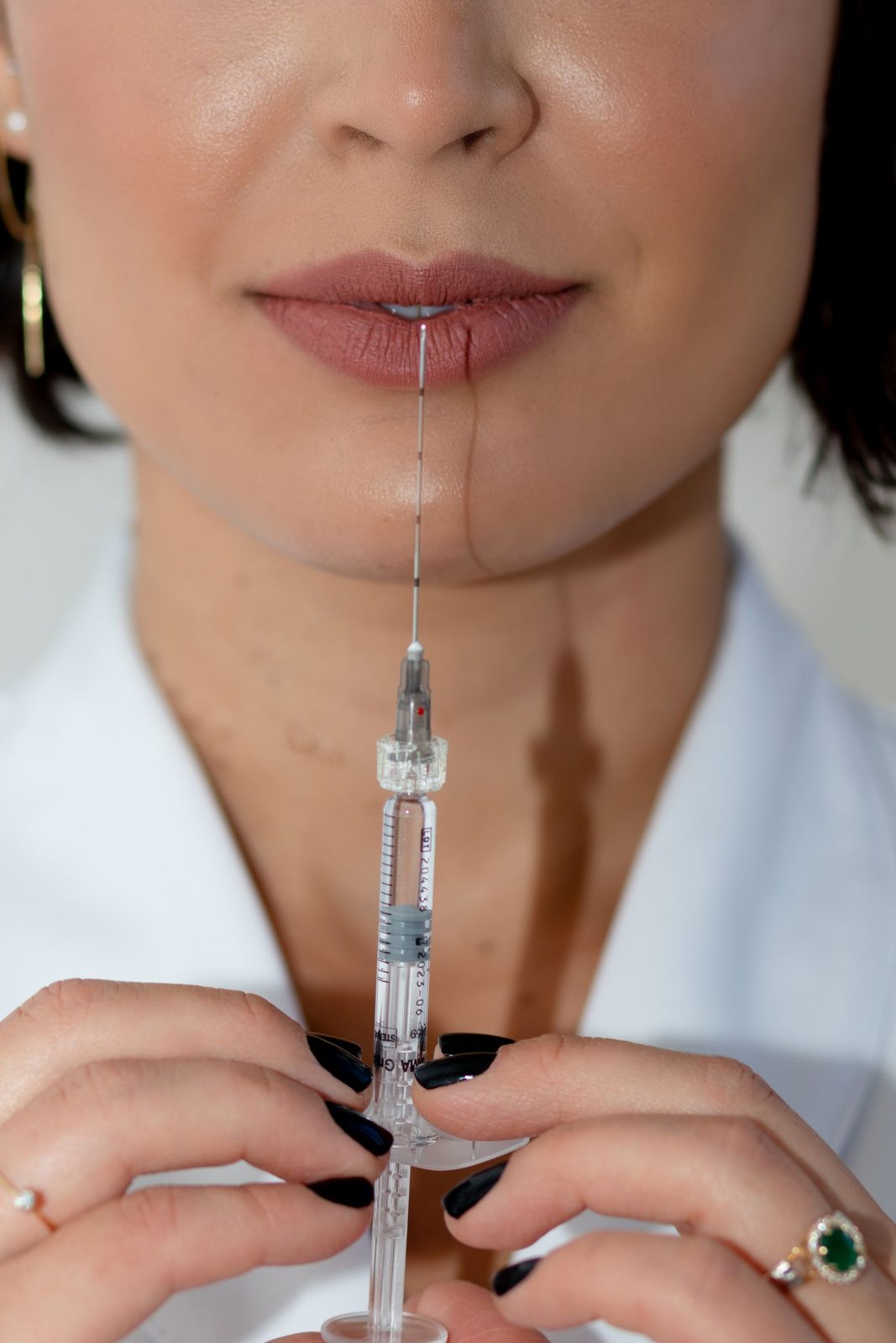Dermal Fillers results at Skin&Co, Mississauga