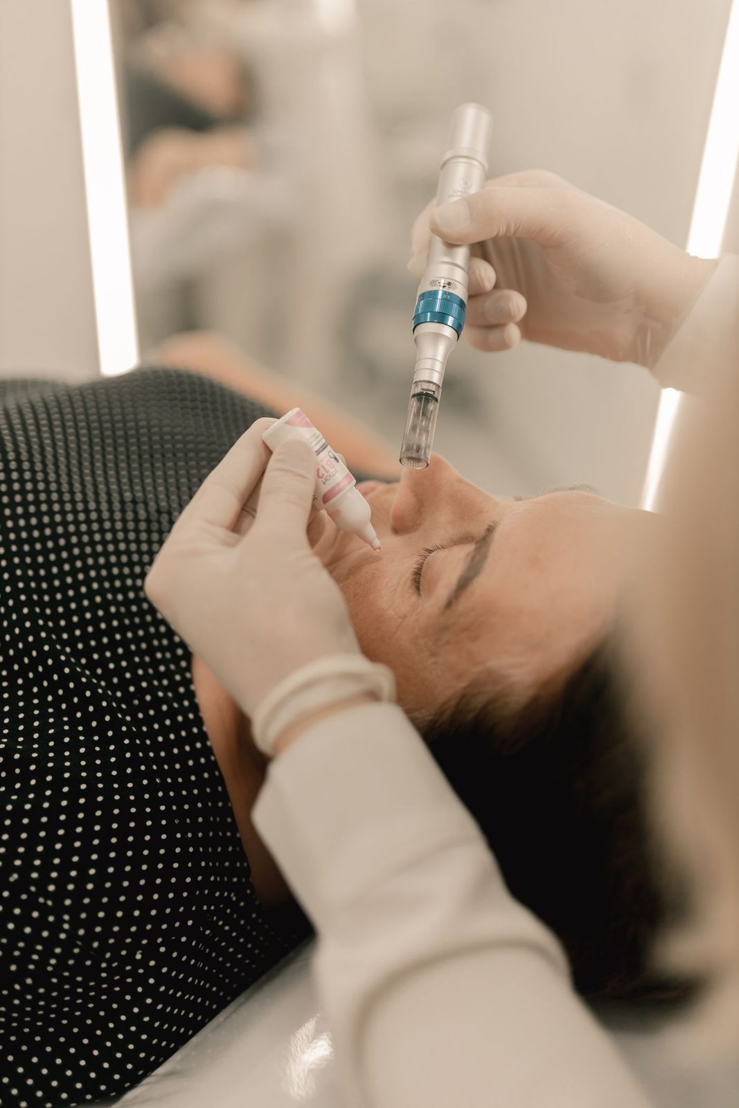 Concerns treated by micropen in Mississauga