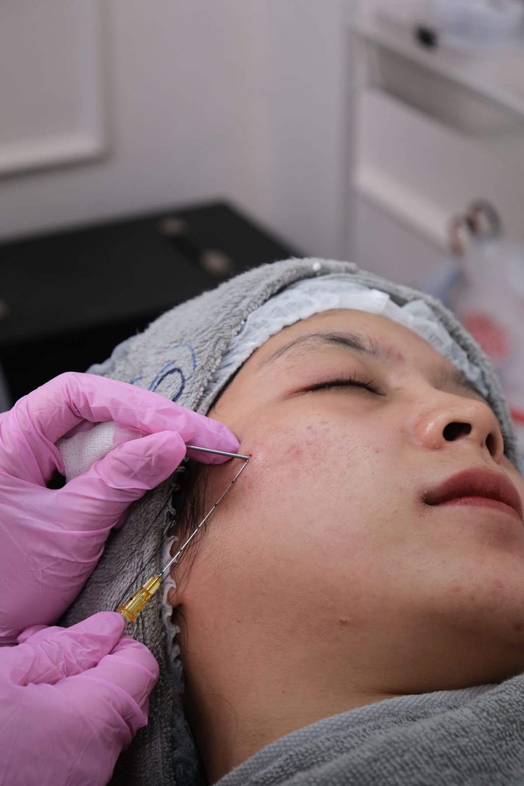Concerns treated by bela md hydrafacial in Mississauga