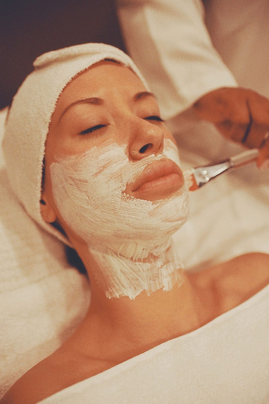 Concerns treated by chemical peel in Mississauga