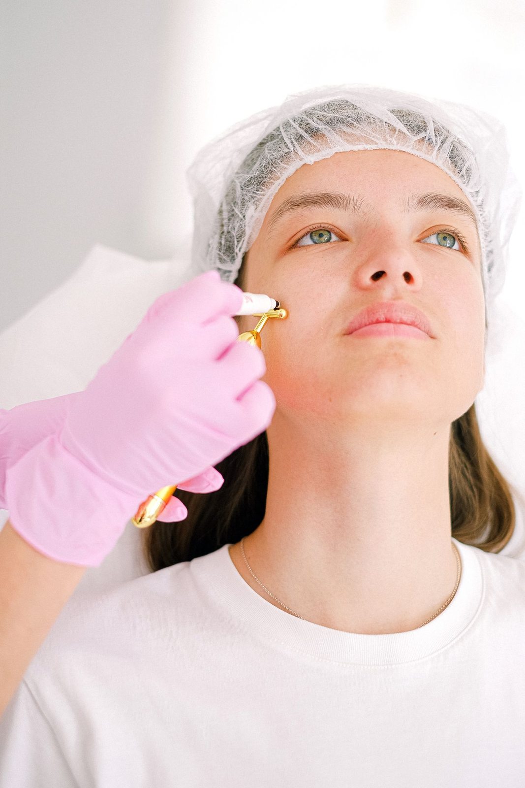 Pulse Dye Laser in Mississauga, step 3: treatment