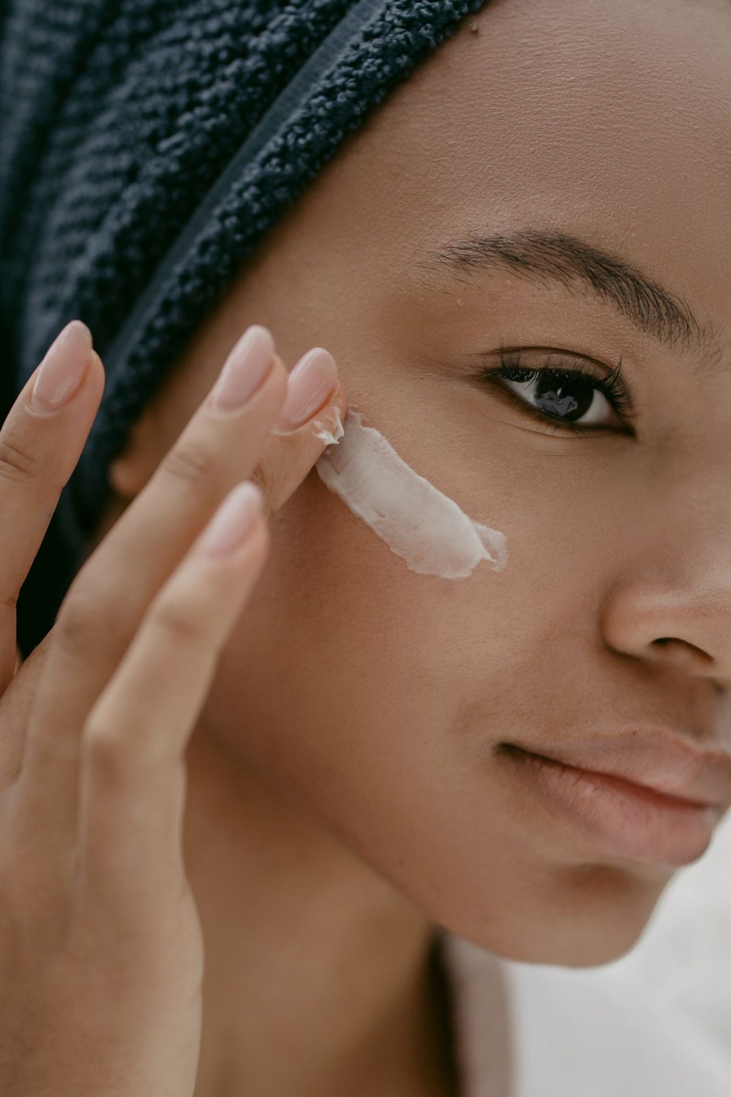 Pulse Dye Laser in Mississauga, step 1: dermatological assessment