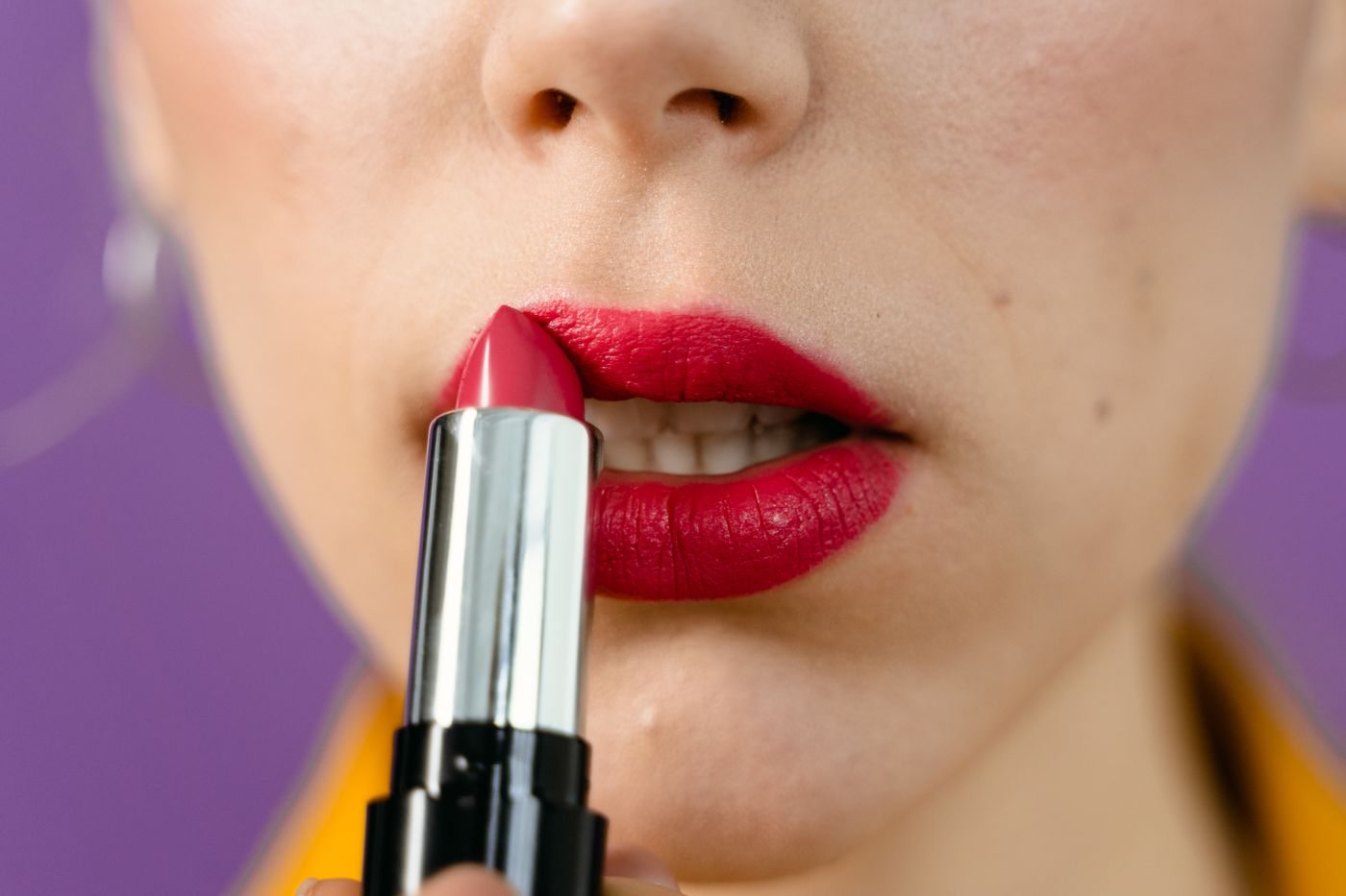 Concerns treated by dermal fillers in Mississauga