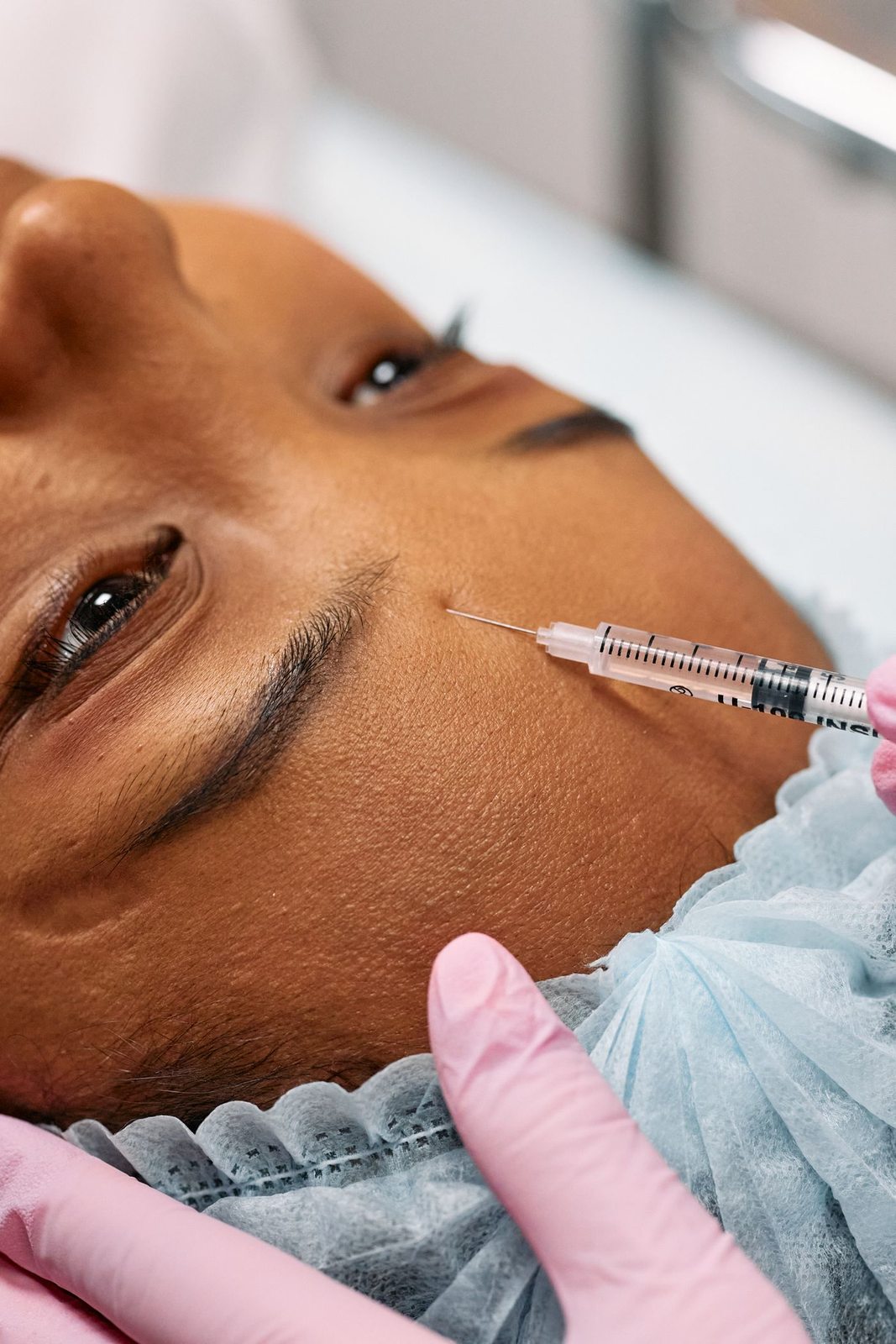 Hyperhidrosis Treatment in Mississauga, step 3: treatment