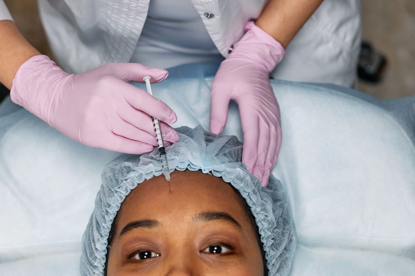 Dermal Fillers in Mississauga, step 3: treatment