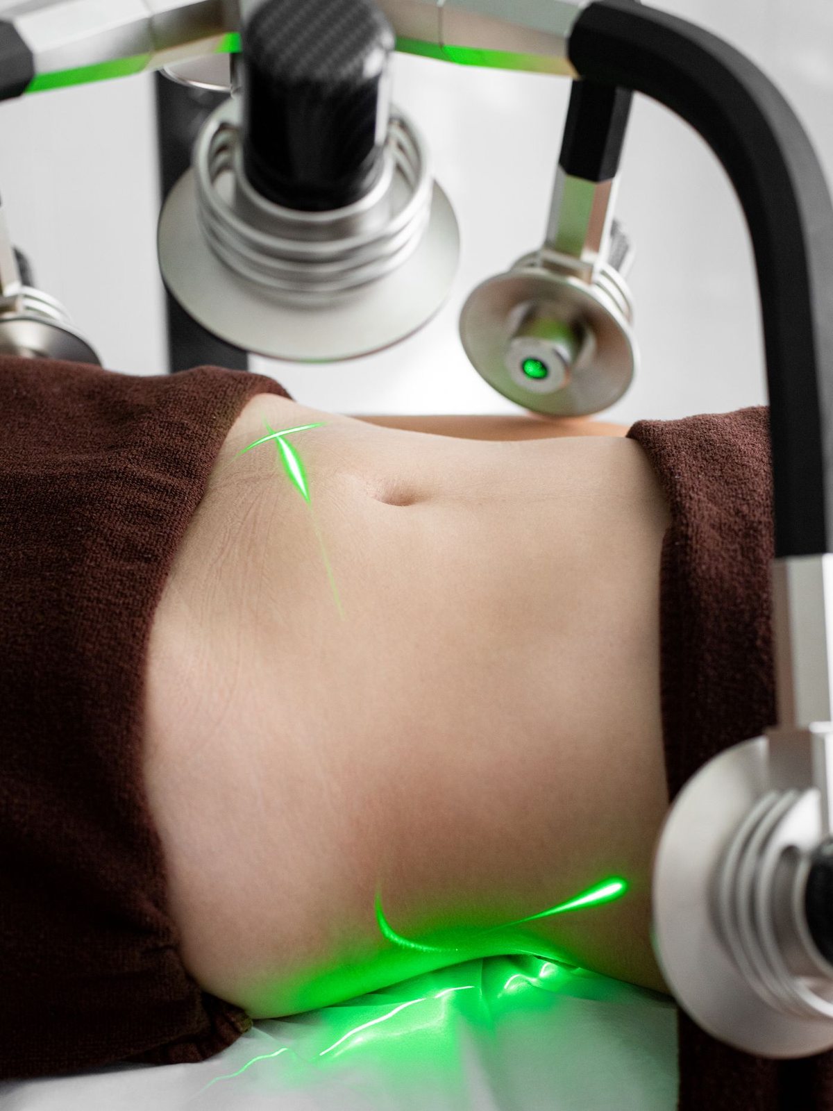 Concerns treated by vein treatment in Mississauga