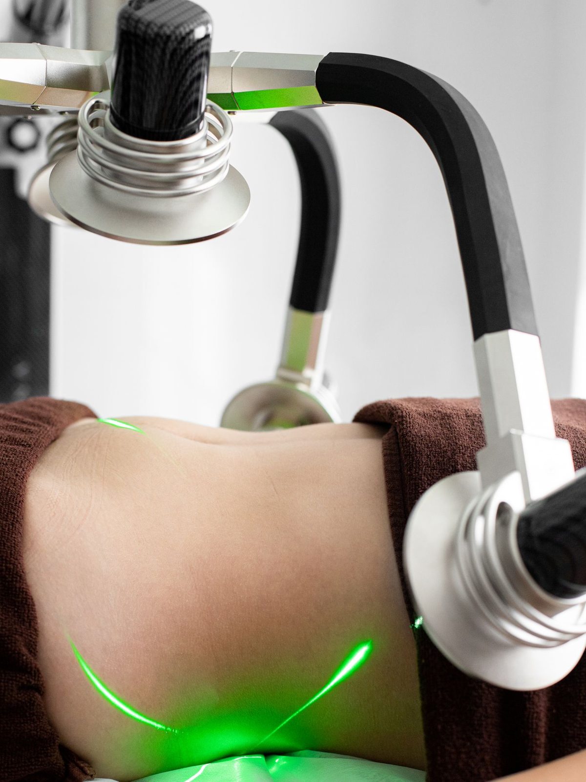 Vein Treatment in Mississauga, step 1: assessment